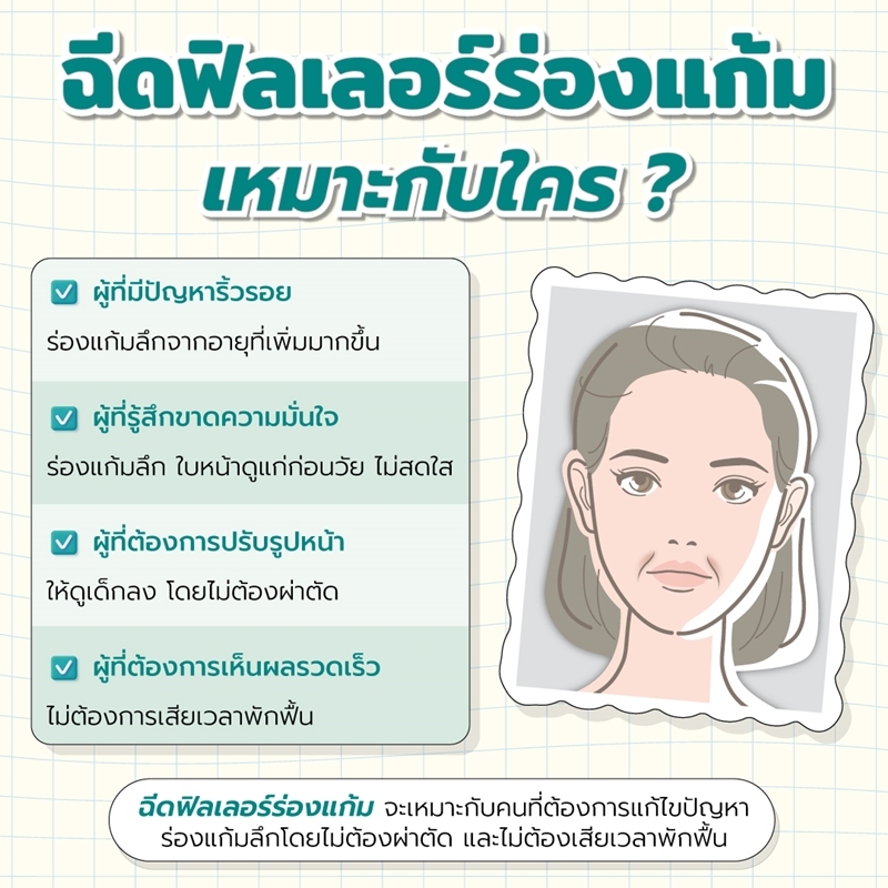 ฉีดฟิลเลอร์ร่องแก้ม เหมาะกับใคร