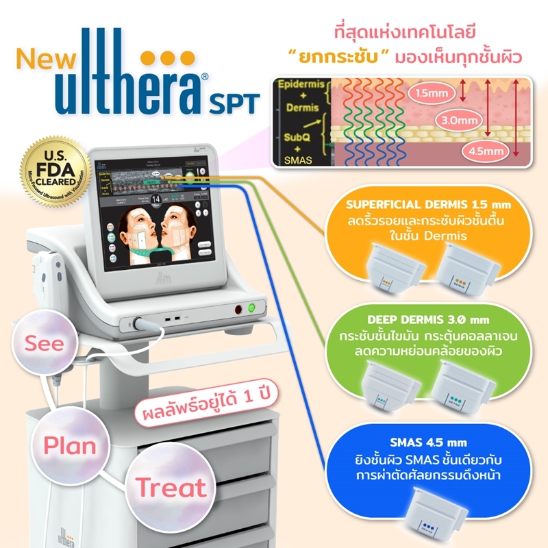 หัวยิง Ulthera